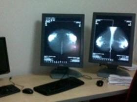 240x0-mamograf.jpg