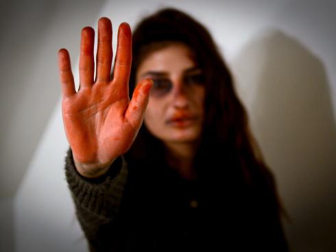 Nasilje nad ženama; Foto: Pexels/Tijana Bošnjakov