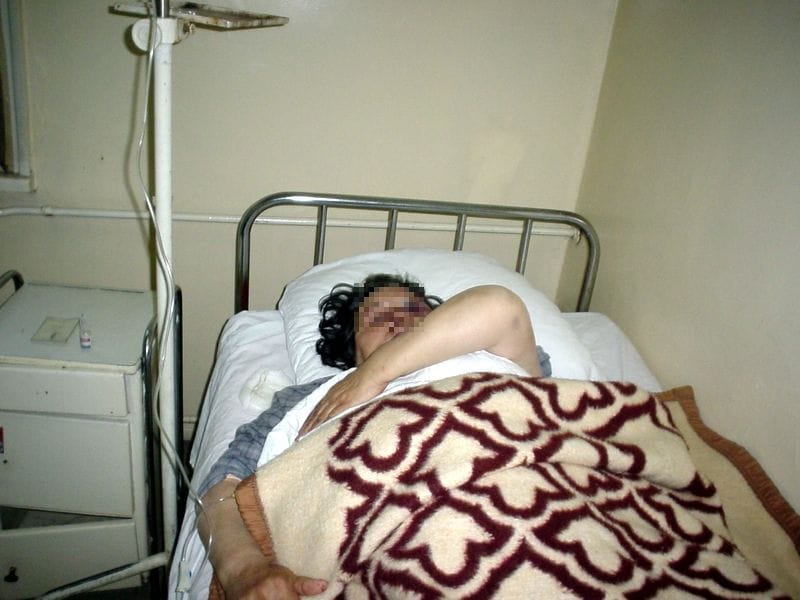 Visnje prebijena Radmila