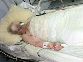 490x370 starici iskopali oci