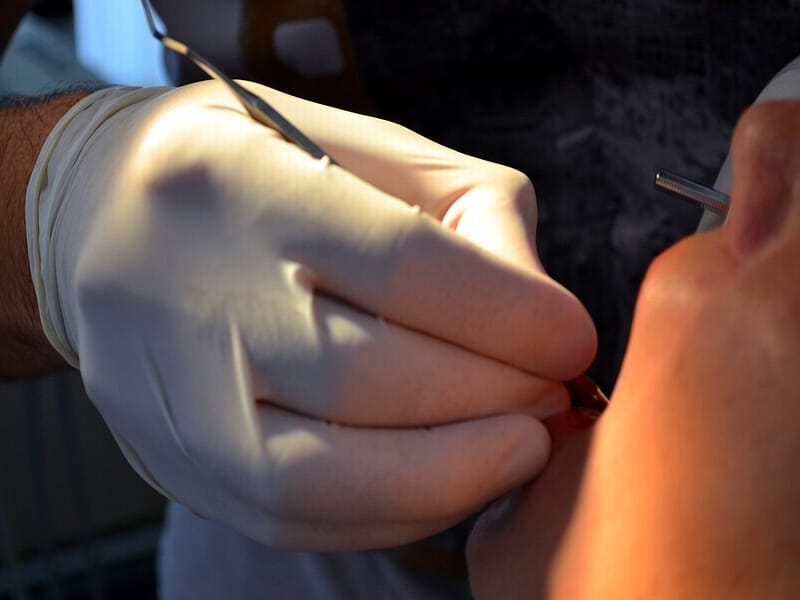 KOSTA stomatologija zubar ILUSTRACIJA Juzne vesti