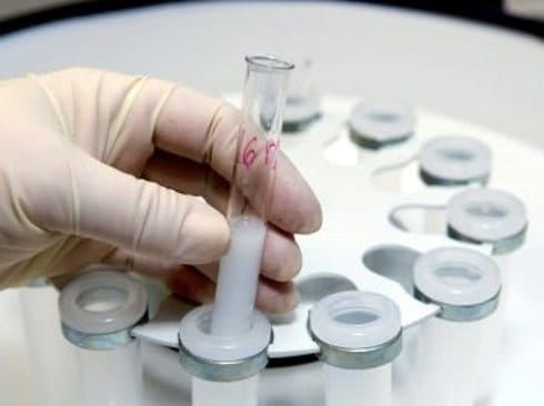 vantelesna oplodnja blic rs