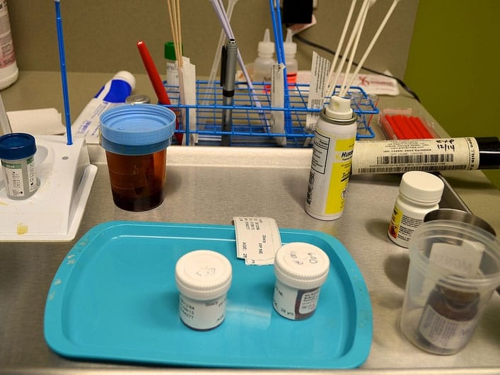 Na poziv za pregled odazvala se svaka 10. žena 7 rak grlica