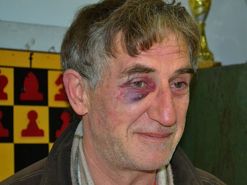 Napadnut svrljiški šahista Miroslav Tošić 10 Miroslav Tosic sahovski velemajstor Svrljig JUZNE VESTI Kosta