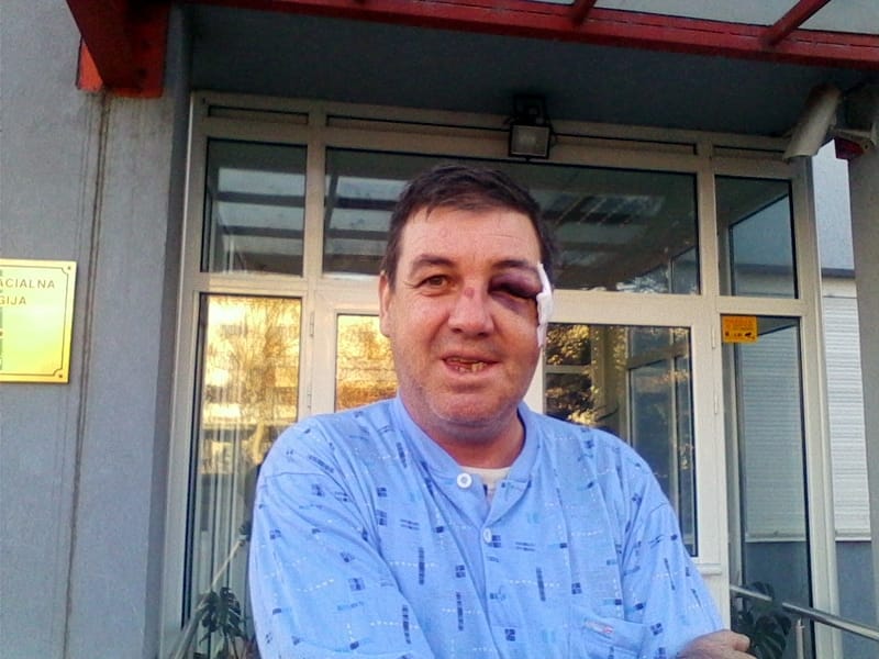 surdulica pretukao ga policajac