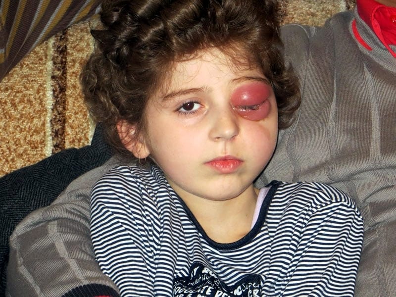 Pogoršano stanje male Anastasije 2 Untitled 1