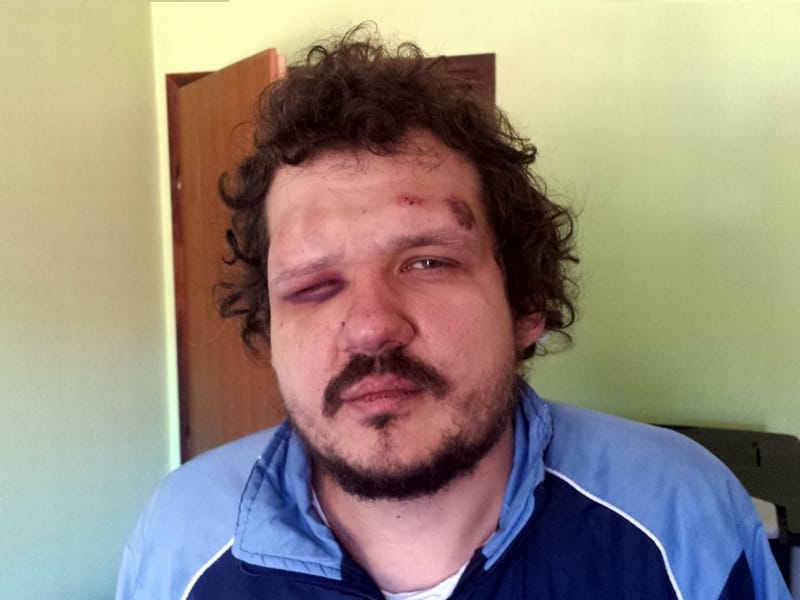 Identifikovan jedan od napadača na odbornika URS-a 13 Tomislav