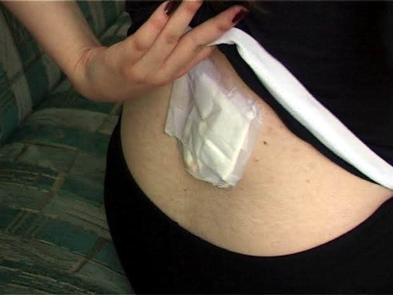 Devojka ubodena nožem u Leskovcu 4 devojka ubodena nozem