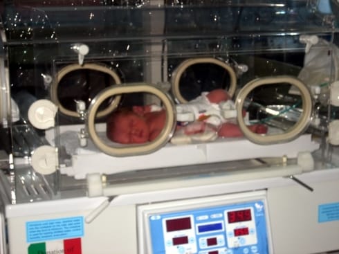 490x370 Bitka za porodilista jpg