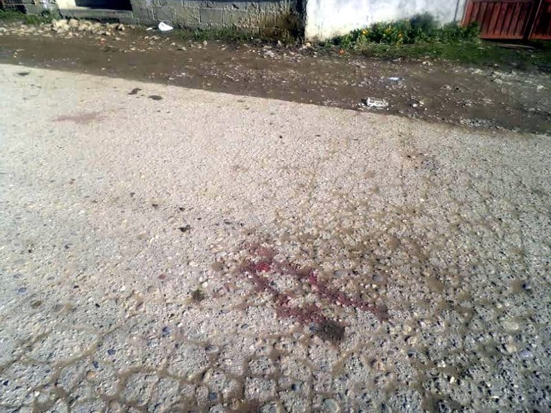 Sekirom komšiji polomio lobanju 1 prodavnica mesto tuce