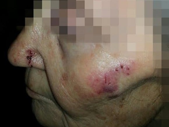 Ženu ujeo pacov u kući u centru Niša dok je spavala 10 Ujed