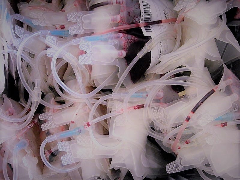 Prokupačkoj bolnici hitno potrebne negativne krvne grupe 20 davaoci krvi foto Aleksandar Kostic