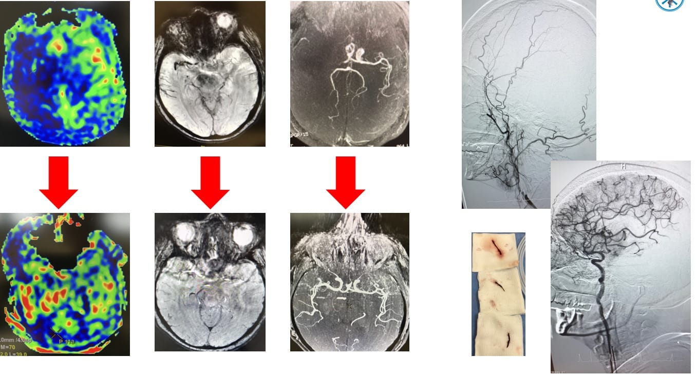 SLIKE PRE GORE I POSLE INTERVENCIJA DOLE