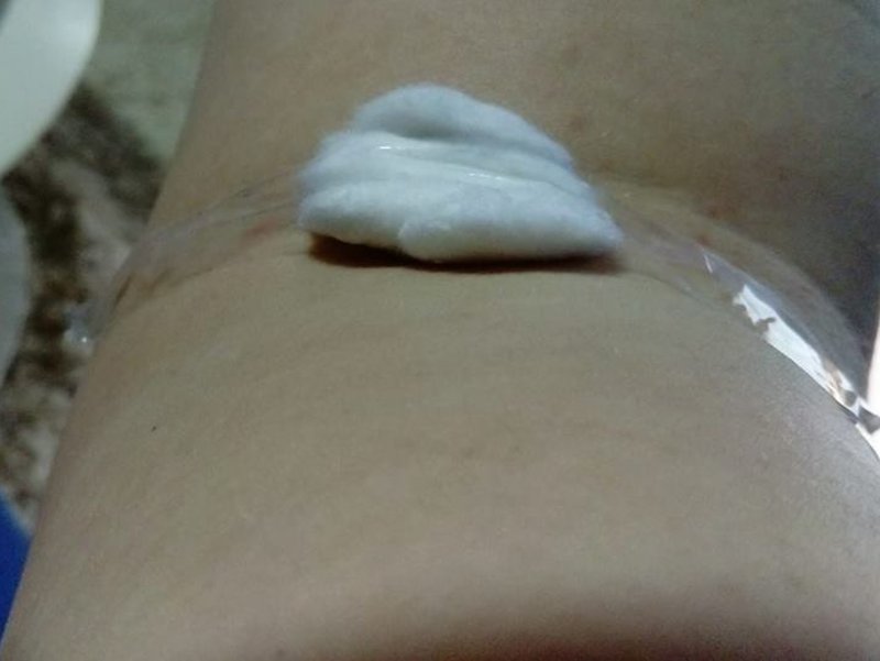 Pacijenti u Higijenski sami donose štapiće i spekulume 1 Selotejp foto MP