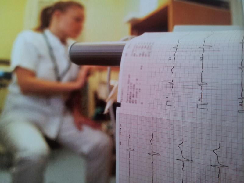 U niškoj Vojnoj bolnici besplatni preventivni pregledi 17 EKG maj 2018 foto flickr Helge V Keitel