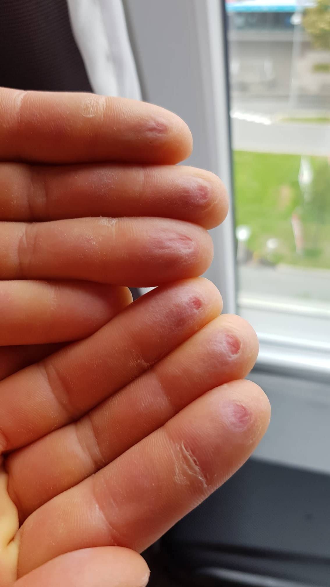 stasa-gejo-posle-sp-foto-sg