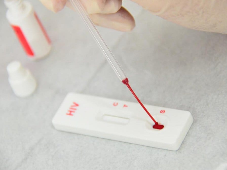 U Nišu u subotu testiranje na HIV besplatno i bez zakazivanja 3 Test HIV ilustracija Foto Flickr ASCOM Prefeitura de Votuporanga