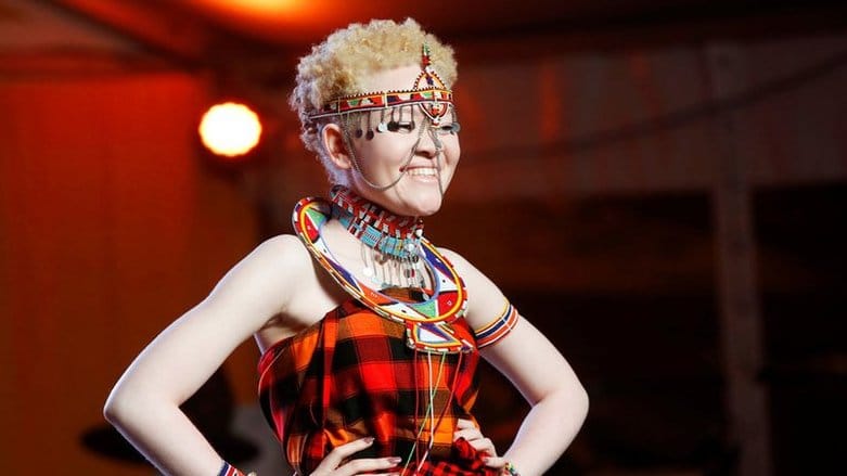 104755938 albinism pageant 5