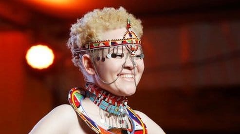 104755940 albinism pageant 5