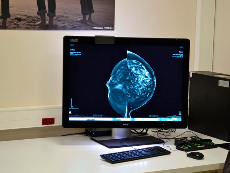 mamograf princeza katarina foto kcnis