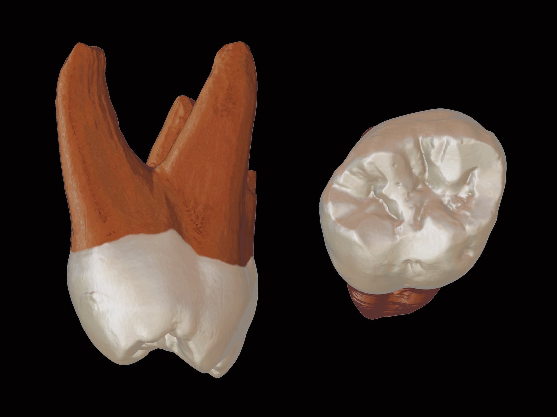 Pronadjeni zub Pesturina FF Beograd