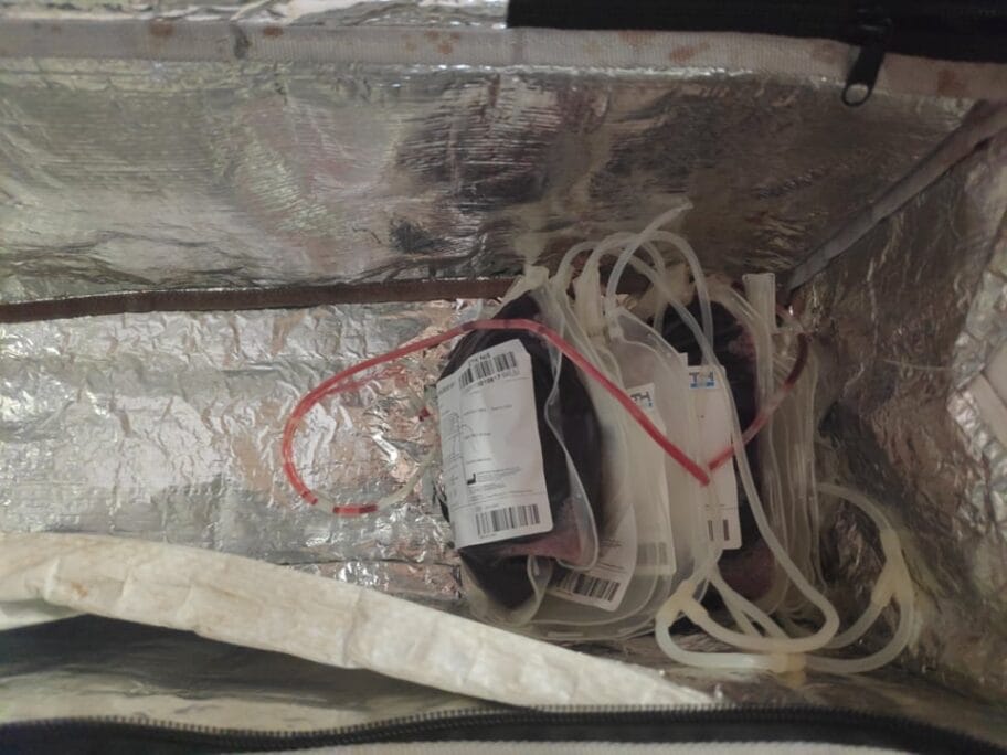 Krv transfuzija foto V M R