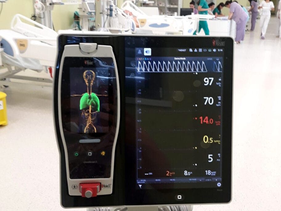 Monitor Radical 7 na Klinici za anesteziju foto KC Nis