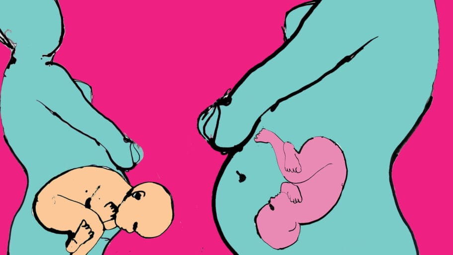 Carski rez ili prirodni porođaj: Kako način rođenja utiče na zdravlje beba 1 100897911 howyoureborn