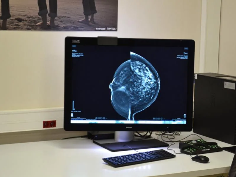 mamograf princeza katarina foto kcnis