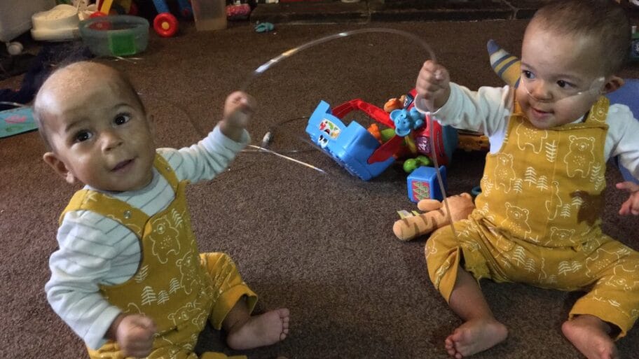 Prevremeni porođaj i blizanci: Kada dodir brata spasi život 7 109762955 twins13