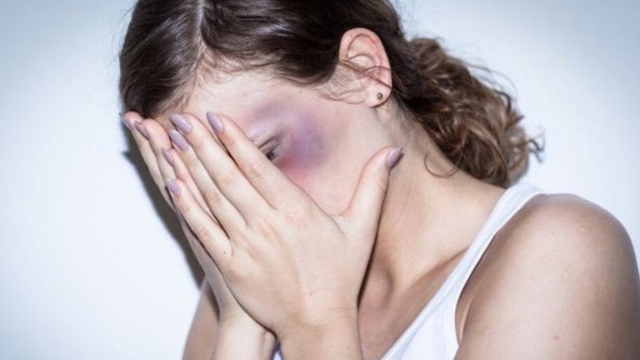 107095535 99750560 violence2