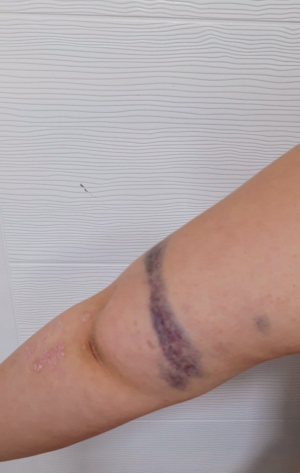 povrede foto licna arhiva