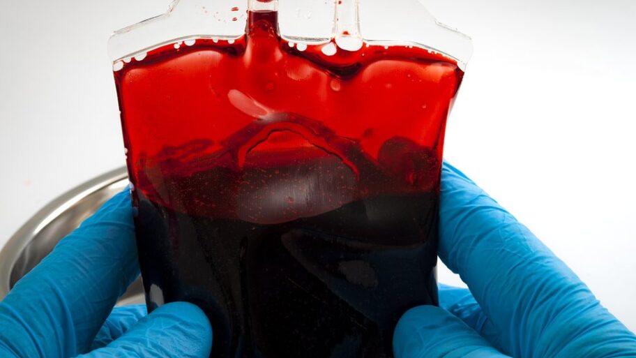 Korona virus i davanje krvi: Hronična nestašica u Srbiji 16 110490307 gettyimages 858822046