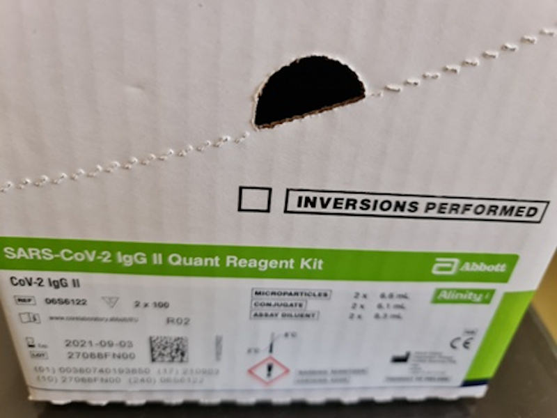 Testiranje na prisustvo antitela virusa korona od sada besplatno u Vranju 16 Test na antitela