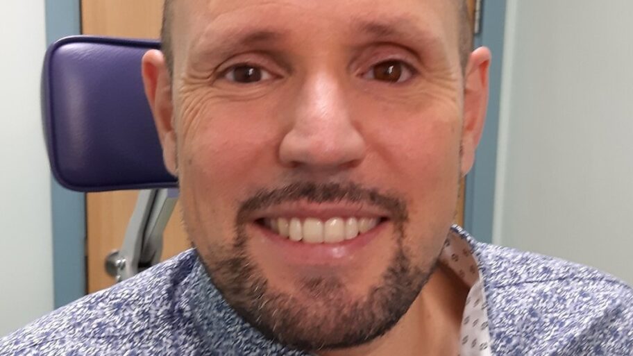 121790480 steveverzeworldsfirst3dprintedprostheticeye