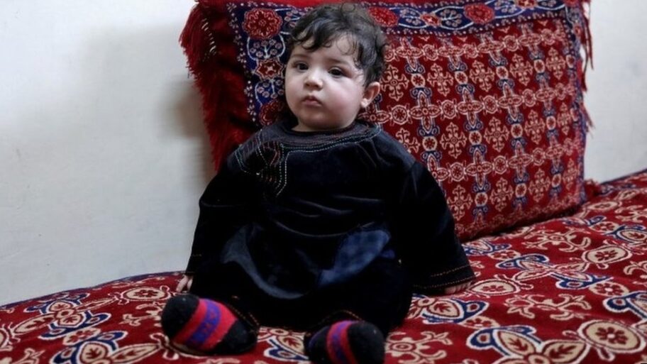 122632920 mediaitem122632915