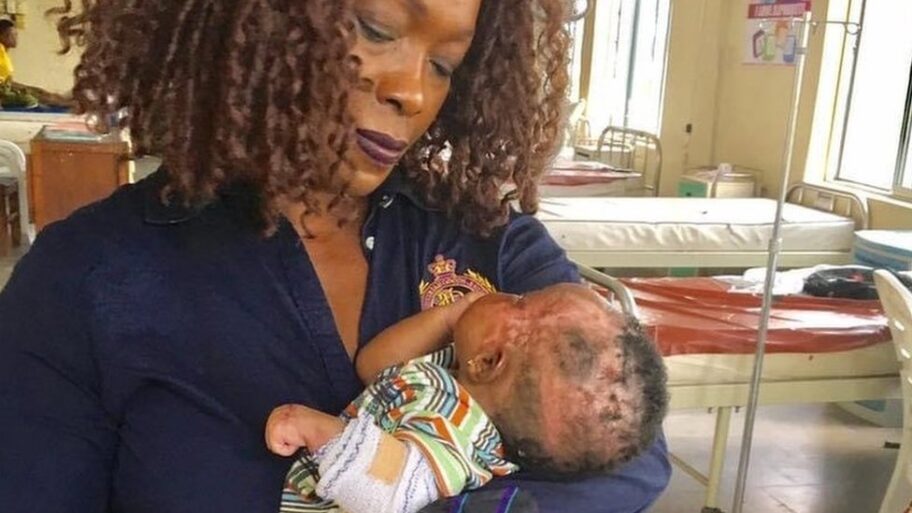 Nigerija: Žena čiji se život promenio kad je posetila koloniju leproznih 18 122692015 mediaitem122013506