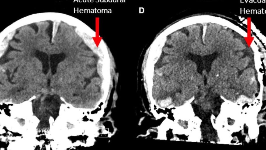 Nauka i zdravlje: Naučnici na pragu velikog otkrića - život nam stvarno prolazi pred očima na samrti 11 123379514 brainscan