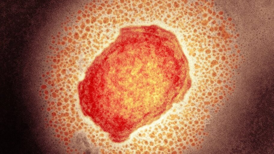 Zdravlje i zarazne bolesti: Majmunske boginje dobijaju novo ime, kažu iz SZO 7 103598601 m0501256 monkeypox virus particle tem spl