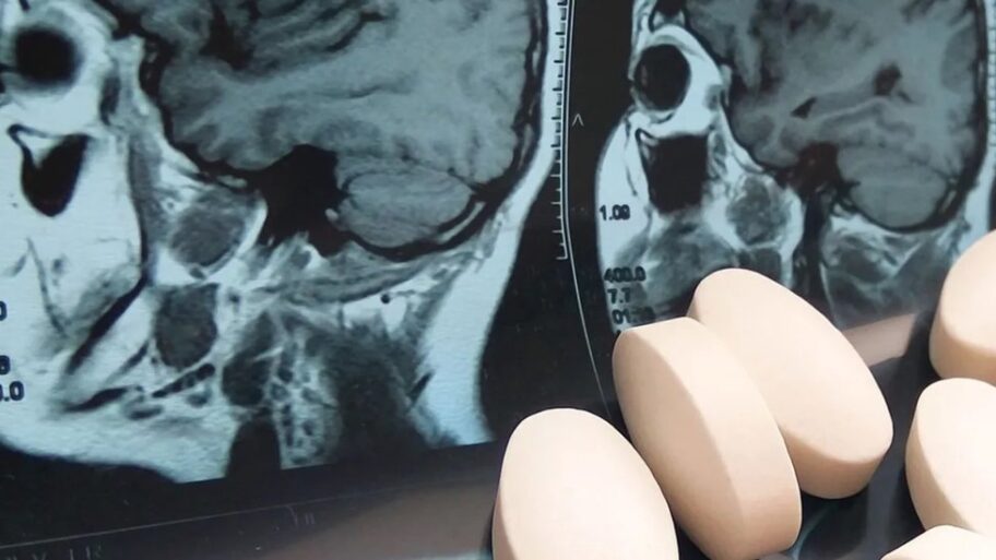 Zdravlje i medicina: Lekovi koji menjaju ono što smo 4 128355258 lekovi1