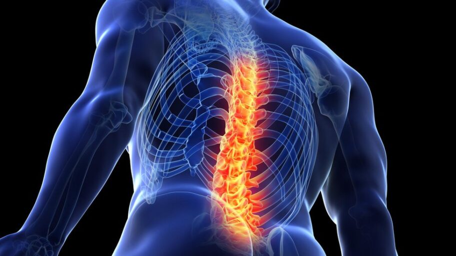 Zdravlje: Pet stvari koje treba da znate o bolovima u leđima 15 128972792 whatsubject