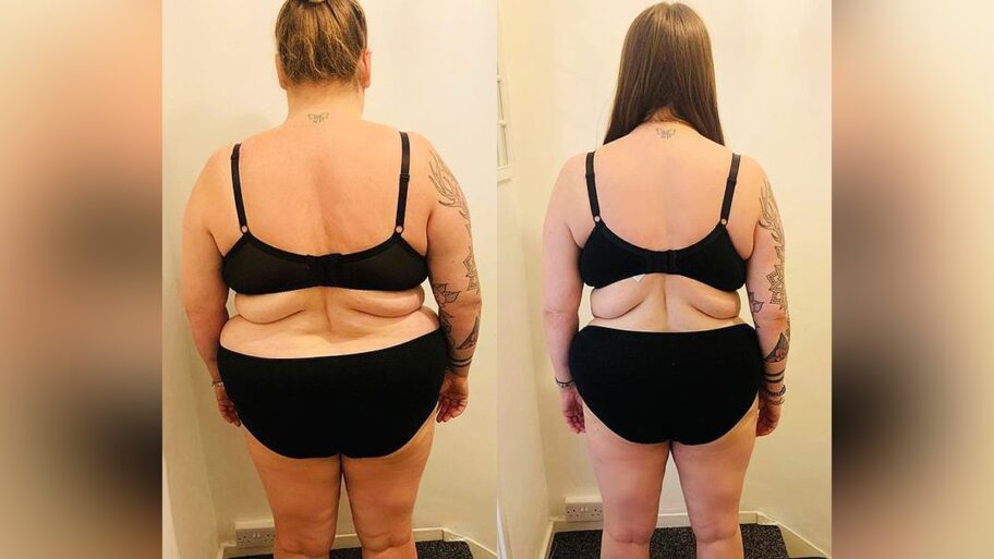 129249239 1024beforeafter