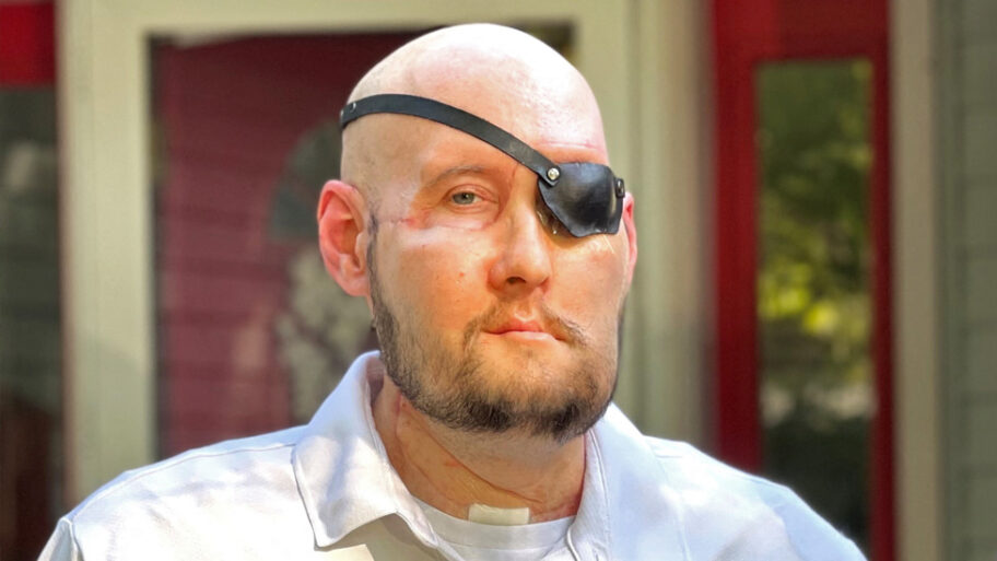Medicina: Uspela prva transplantacija oka, vid nije vraćen, ali je napravljen „korak napred" 14 131667424 eyetransplant index reuters