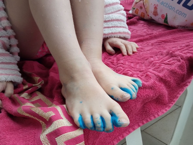 Kupači u SC "Čair" ofarbani izašli iz bazena, nadležni im dali hidrogen da se očiste 14 IMG 0360