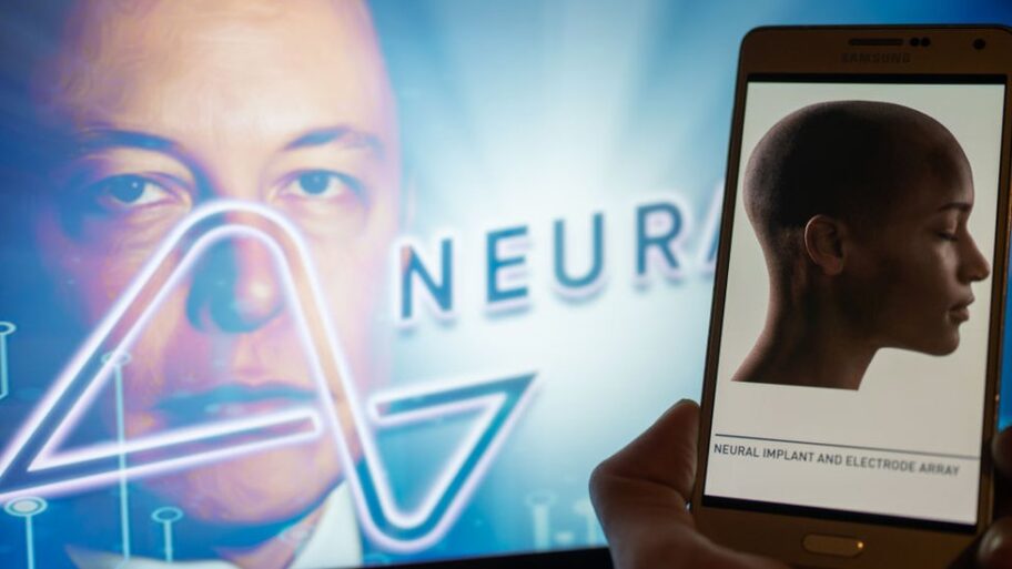 Neuralink: Kompanija Ilona Maska ugradila moždani čip u čoveka - „Telepatija će pomoći bolesnima" 18 132498404 neuragetty