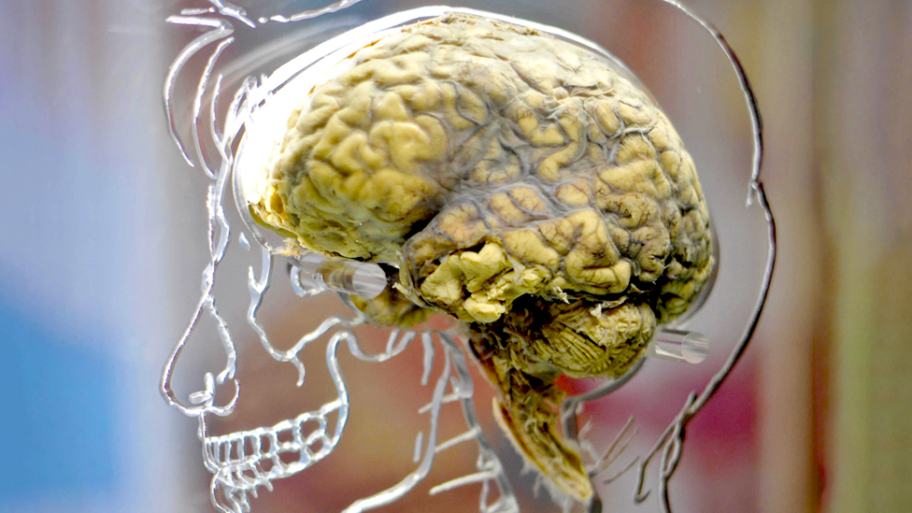 133211494 00digitalnademencijacover