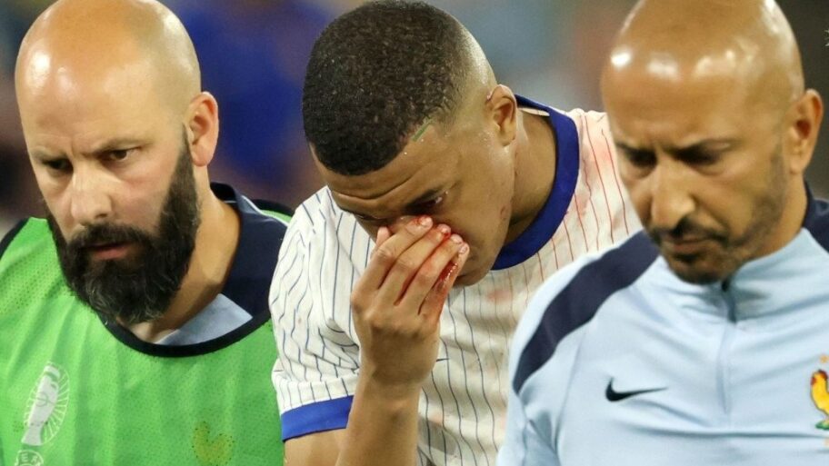 Euro 2024: Kilijanu Mbapeu slomljen nos - zebnja u francuskoj reprezentaciji, Srbija ostala bez Filipa Kostića 8 133456174 ddd8d2358875f80c7a9412aedd5c490c6a956470 1