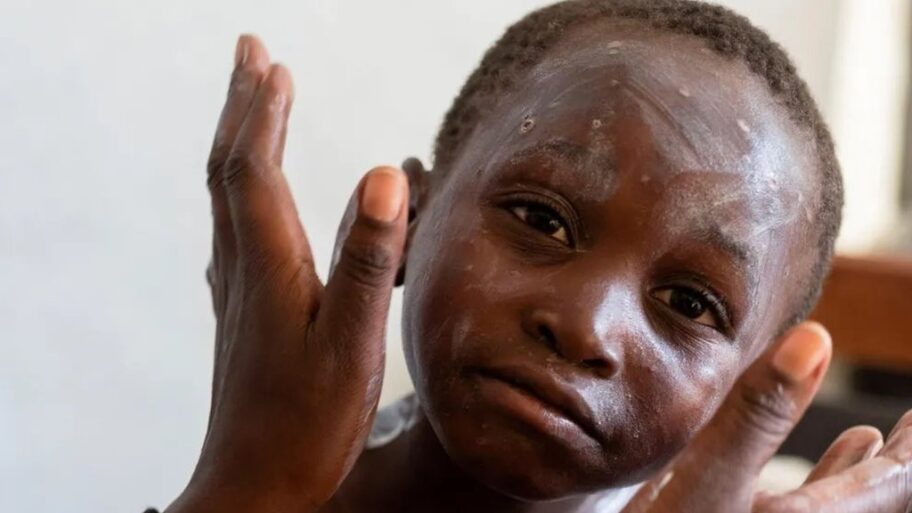 133542584 6d9da80c 791c 4106 8acd 8045a793be62