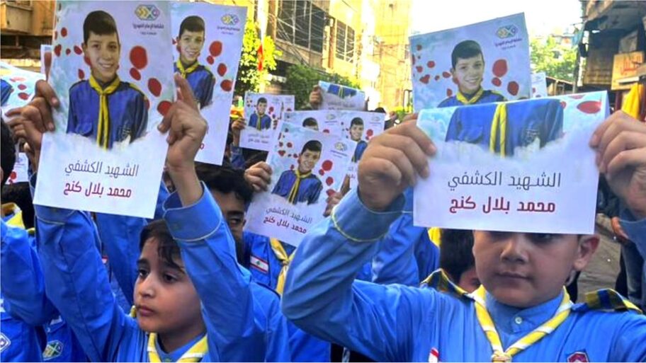 Eksplozije u Libanu: „Ko god da je izgubio oko, boriće se sa drugim okom“ 7 133580066 c71f4216 46a7 4bdc bd64 e3c6004eee73