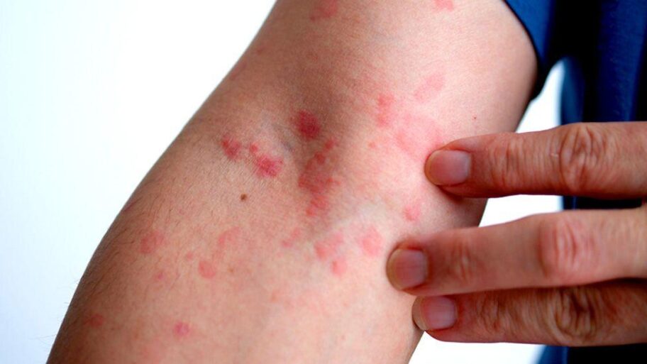 39b73110 ef6f 11ef a319 fb4e7360c4ec